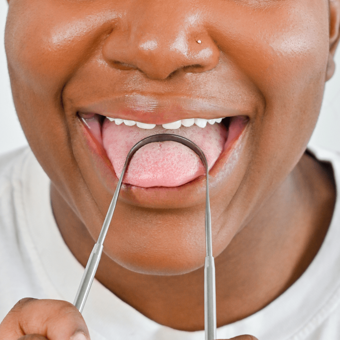 Mintier - Stainless Steel Tongue Cleaner - Medical-Grade Oral Care Tool